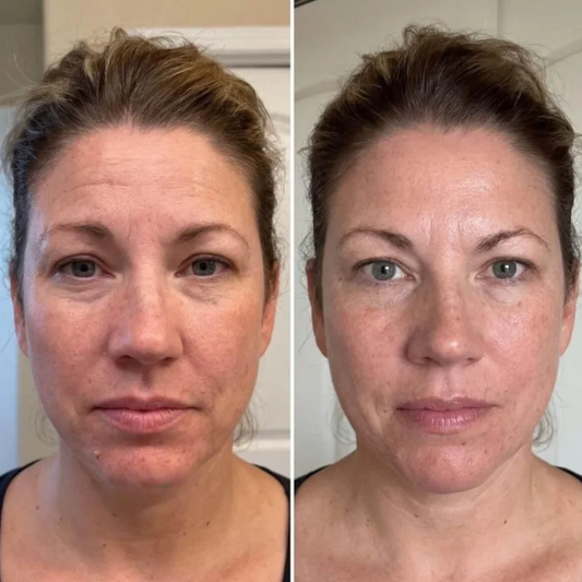 Velau™ Rent Collagen Stift